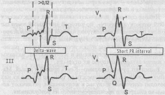 CLC Syndrome.jpg